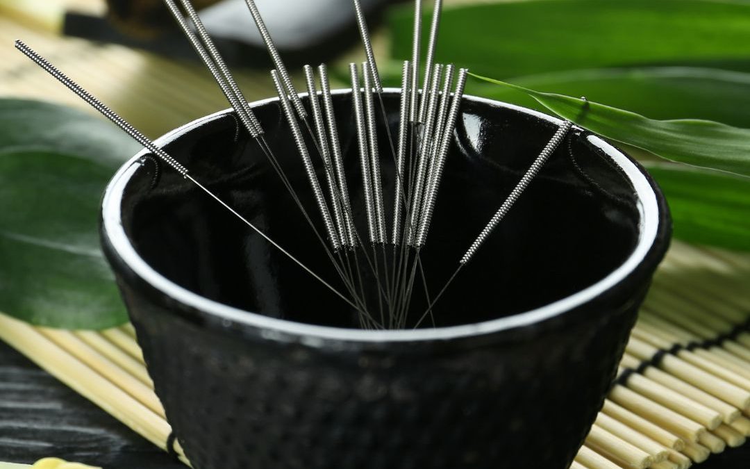 FOR OUR COMMUNITY… ACUPUNCTURE!