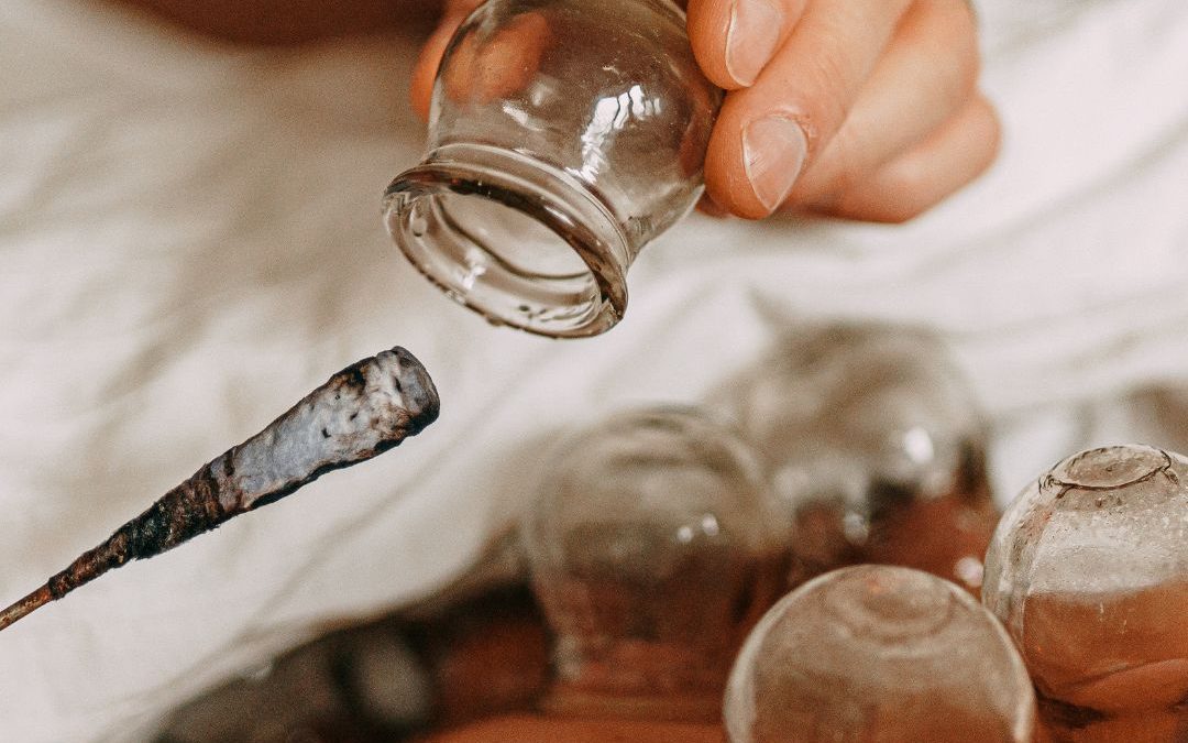 Cupping 101 – The Magic of Suction