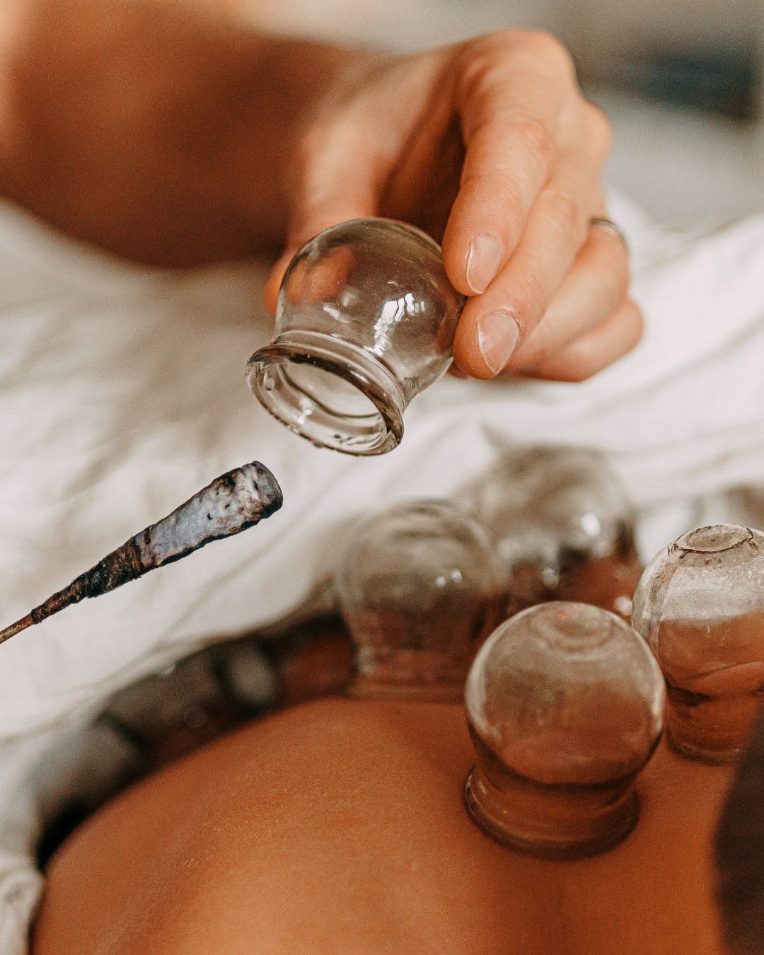 Cupping 101