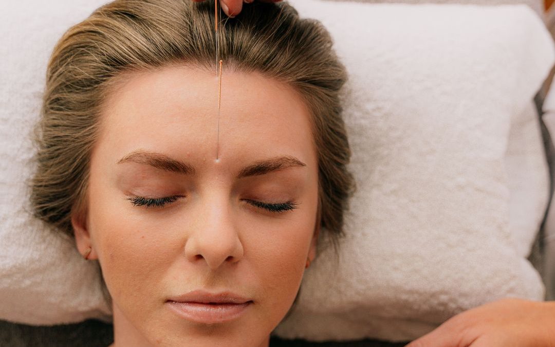 What is Facial Rejuvenation Acupuncture?