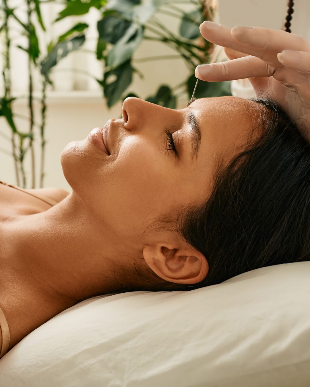 Facial Rejuvenation Acupuncture