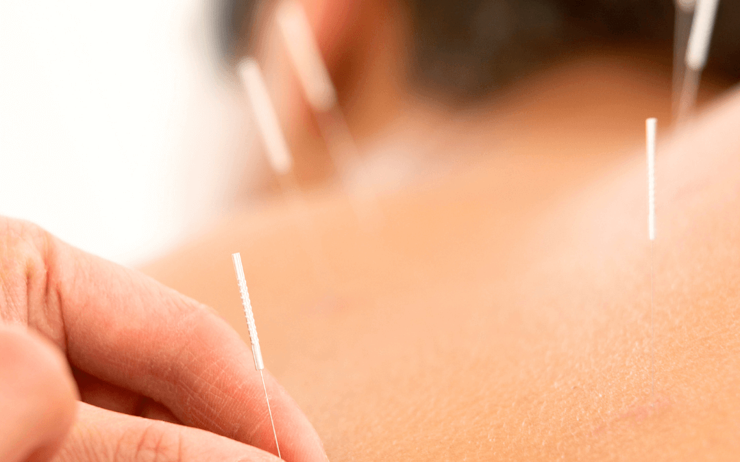 Improving Resilience & Reducing Inflammation: How Acupuncture and Traditional Chinese Medicine Can Strengthen Your Immune System