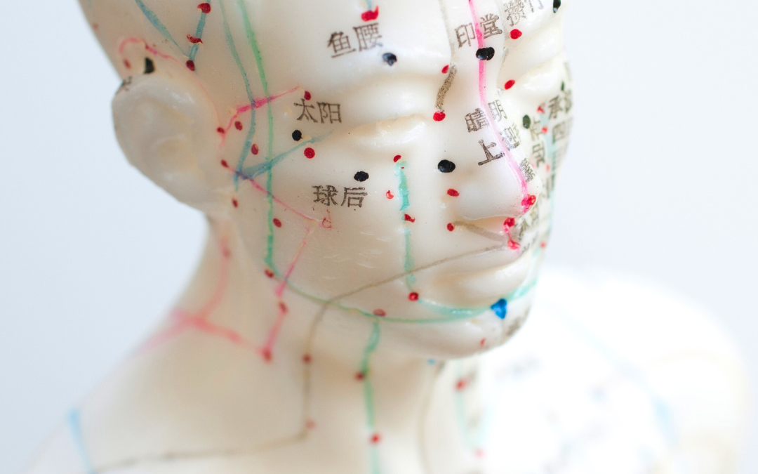 Traditional Chinese Medicine 101: What is Acupuncture?