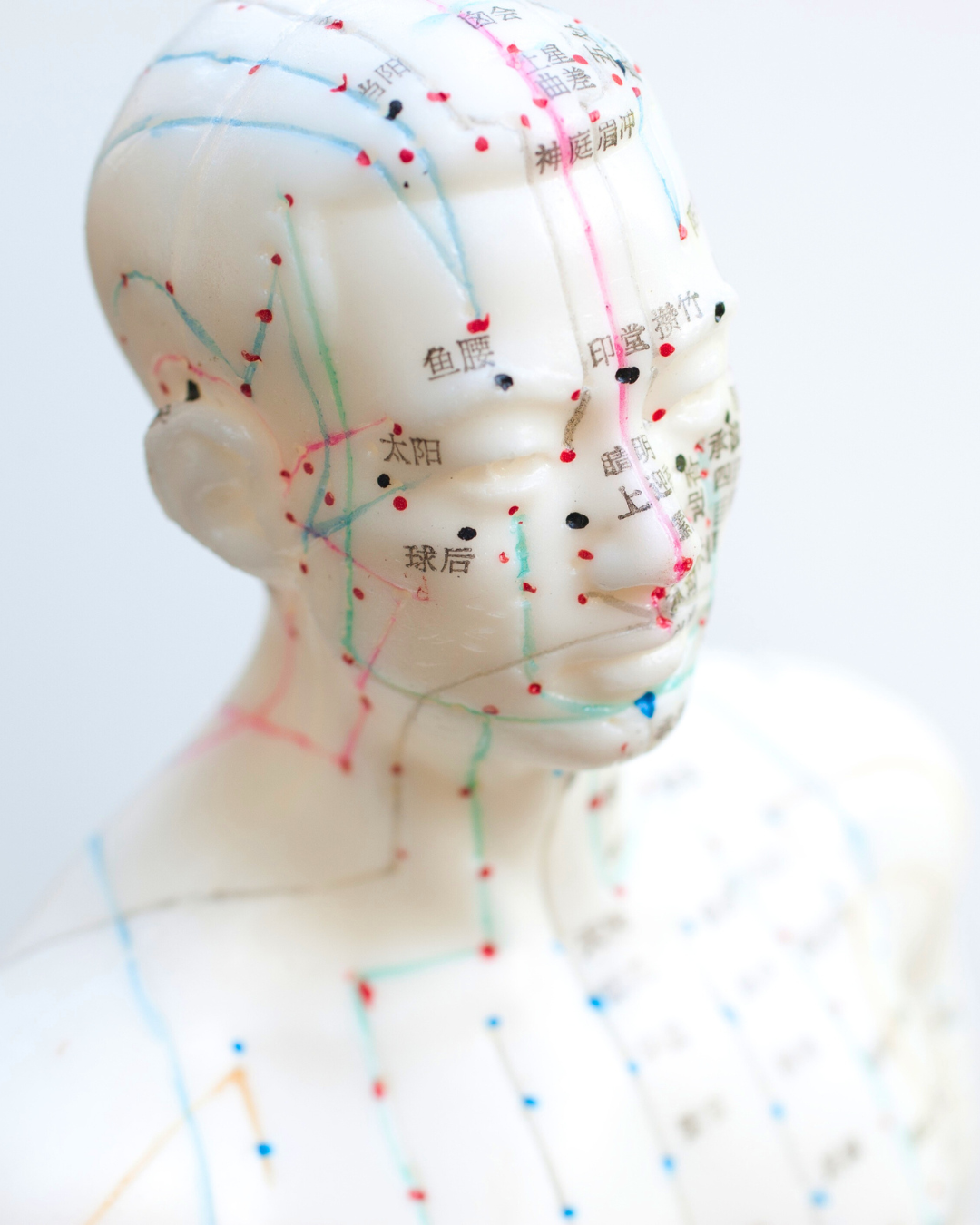 Traditional Chinese Medicine 101: What is Acupuncture?